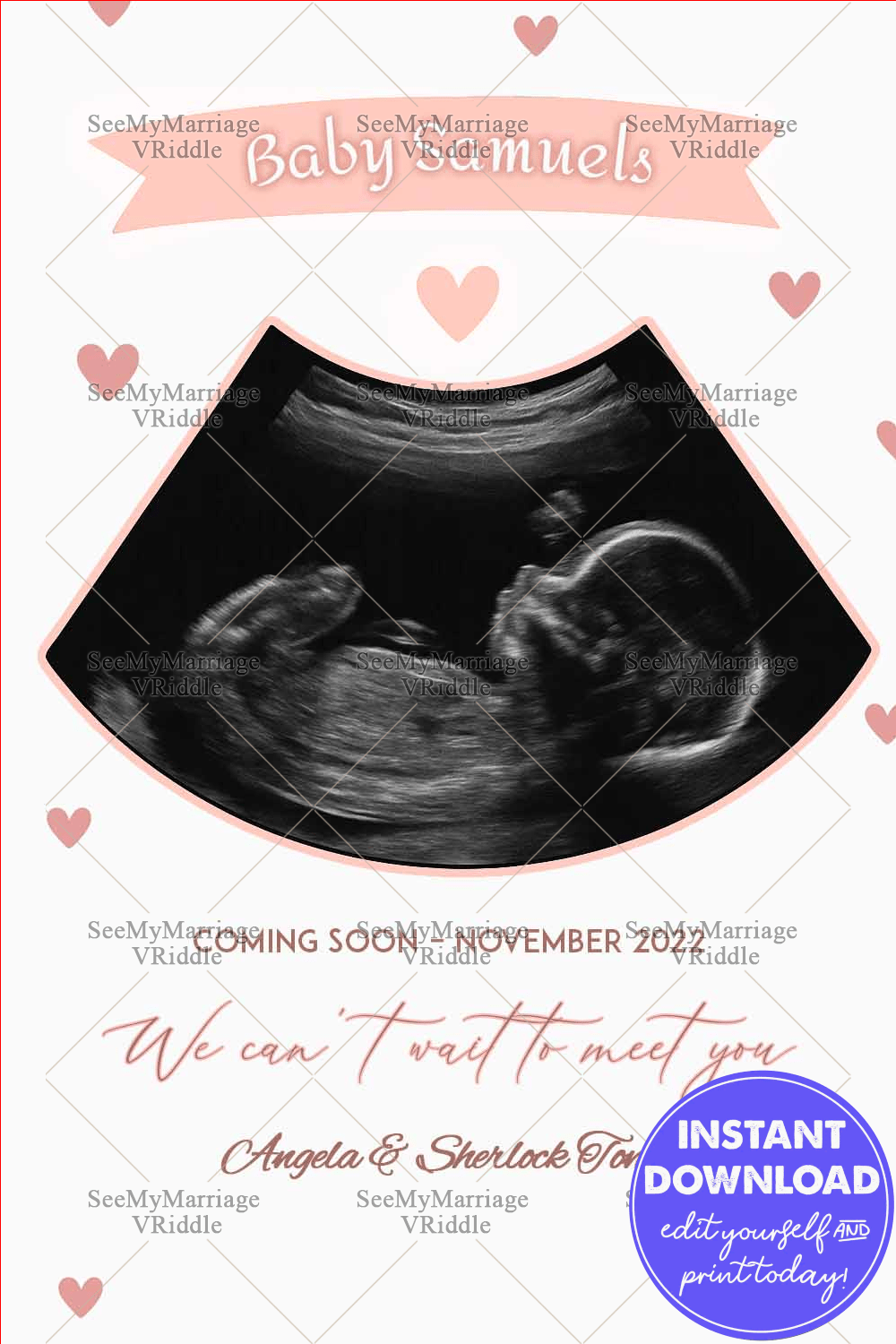 Baby Announcement Card with Baby Ultrasound Image Highlight and Soft Heart Motif