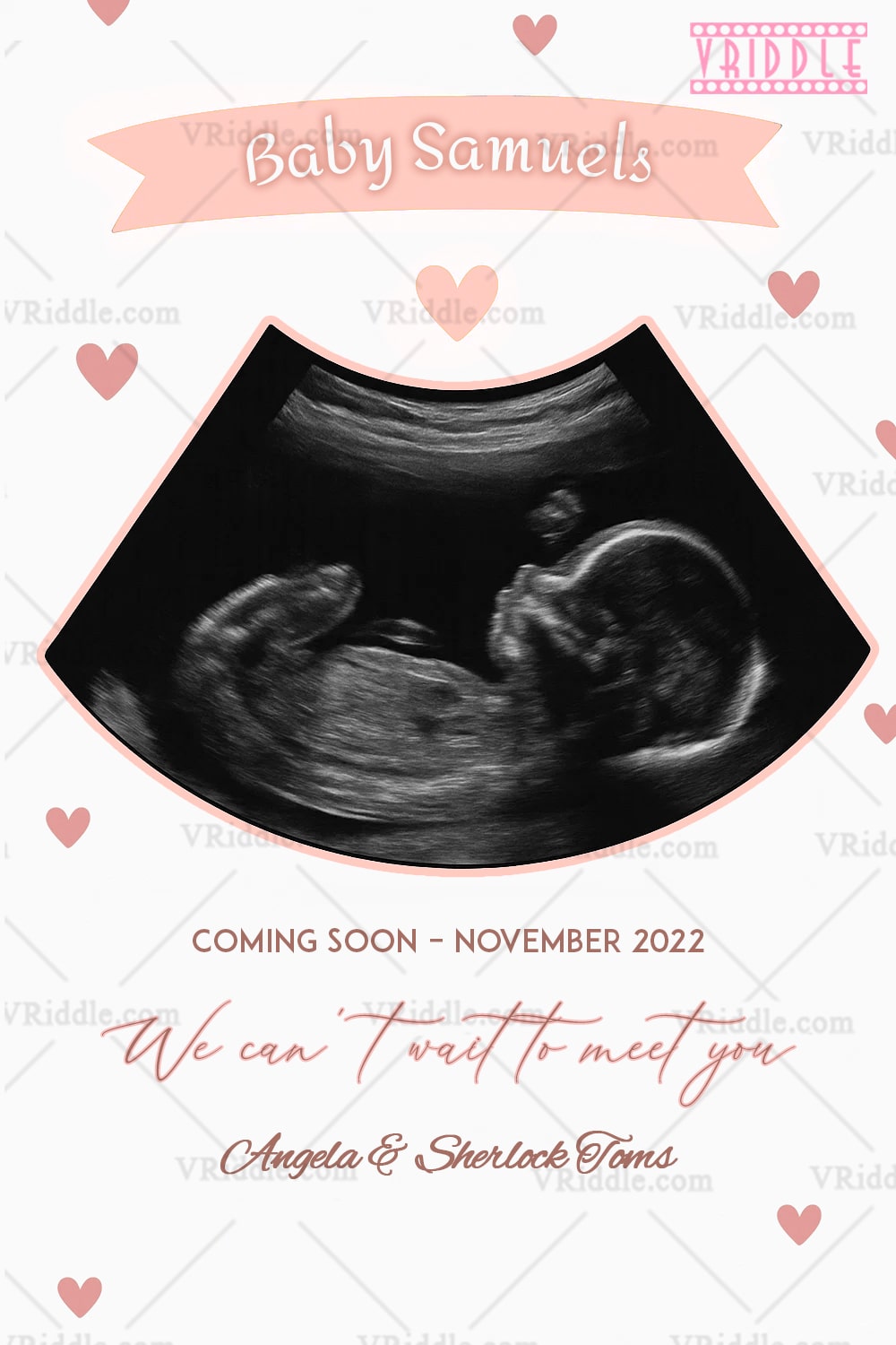 Baby Announcement Card with Baby Ultrasound Image Highlight and Soft Heart Motif