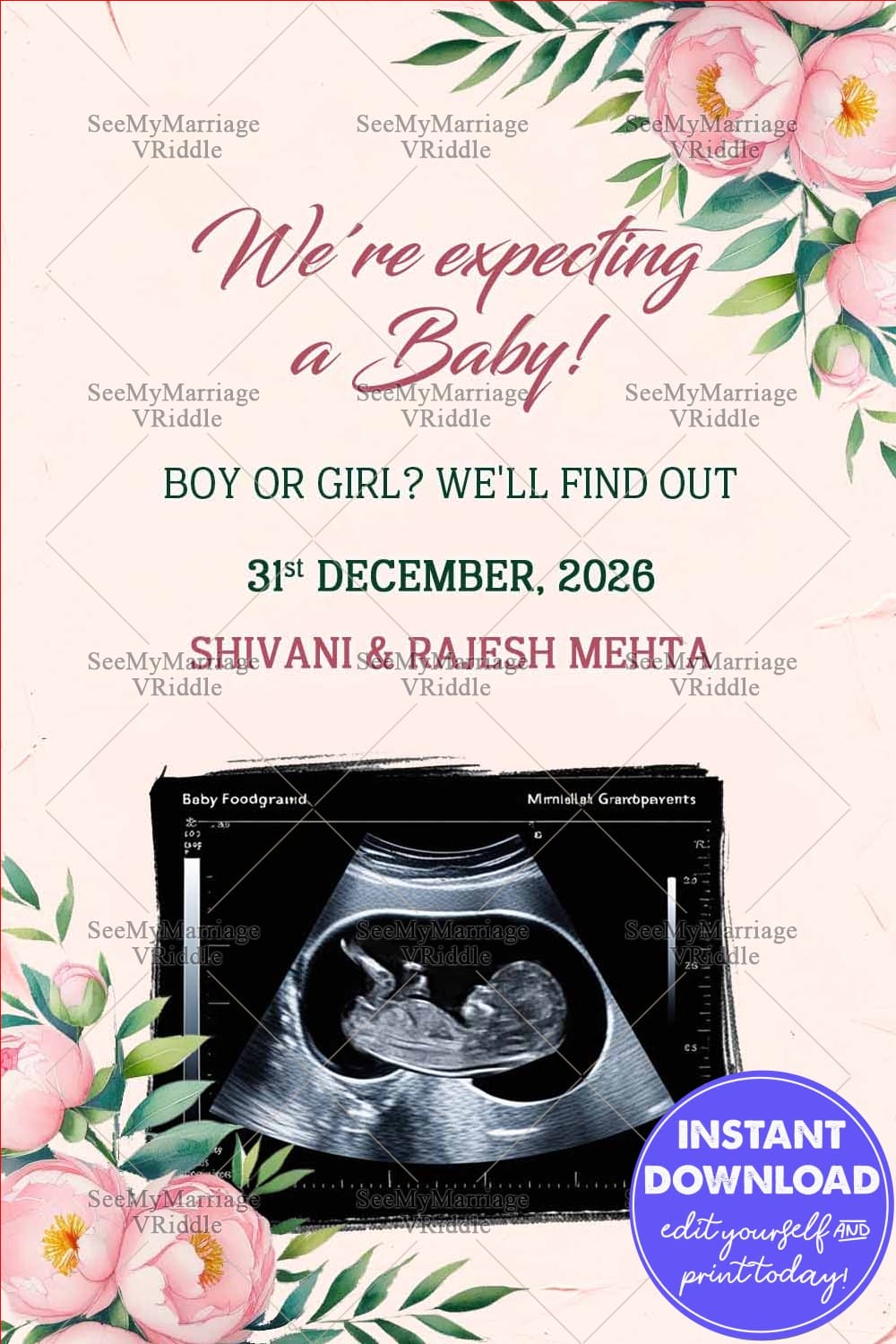 Soft Pink Sonogram Pregnancy Announcement with Add Photo, Photo and Peony Flowers